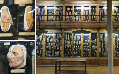 Musée des moulages de l'hôpital Saint-Louis